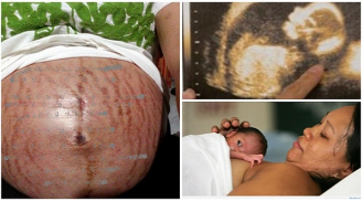 8 lỗi của mẹ bầu khiến thai nhi còi cọc, kém phát triển