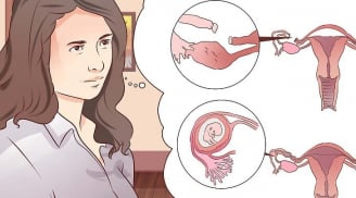 Những dấu hiệu mang thai ngoài tử cung phụ nữ nên biết