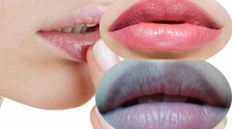 Nhìn sắc môi có thể đoán được tình trạng sức khỏe của bạn