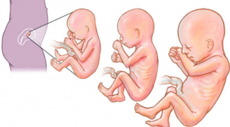 Chế độ ăn theo từng thai kỳ để vào con không vào mẹ