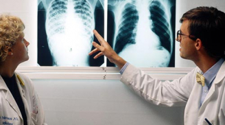 Dấu hiệu nhận biết bệnh lao phổi