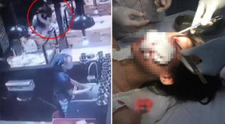 Nam Định: Nam thanh niên ném cốc vào mặt cô gái trong quán nướng
