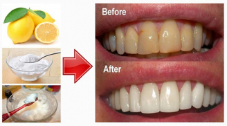 5 cách làm trắng răng đơn giản mà hiệu quả từ những nguyên liệu dễ kiếm trong nhà bếp