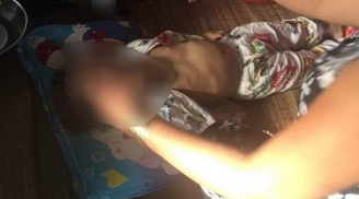 Vĩnh Long: Nghi án bé 4 tuổi tử vong vì bị bạo hành