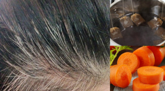 Phương pháp chữa tóc bạc hiệu quả, khiến tóc mọc ra đen nhánh không cần đi nhuộm