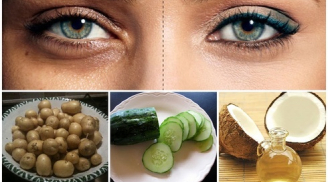 5 cách đơn giản để loại bỏ quầng thâm, bọng mắt hiệu quả nhất