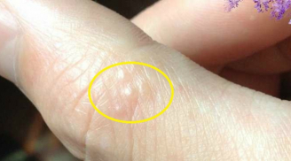 Nếu bạn nhận thấy dấu hiệu này cần lập tức tới bệnh viện ngay kẻo cứu không kịp