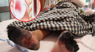 Dùng băng vệ sinh kiểu này nữ sinh 16 tuổi qua đời: Quá nhiều phụ nữ Việt đang mắc