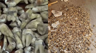 Chết đứng khi phát hiện 1.000 chiếc răng người thật được chôn sâu trong tường