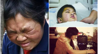 Cậu bé 7 tuổi bị ung thư gan giai đoạn cuối, thủ phạm chính là chất độc trong bếp hầu hết gia đình Việt