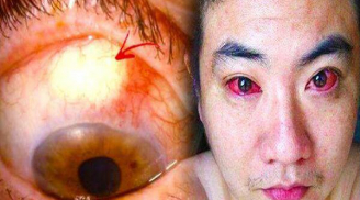 Cảnh báo: Ung thư, mù mắt chỉ vì thói quen sử dụng điện thoại vào ban đêm