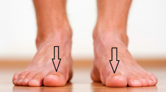 Bàn chân có dấu hiệu này đi khám ngay vì thận của bạn đang kêu cứu