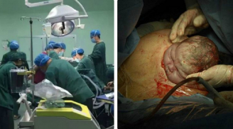 Sản phụ bị cắt bỏ 1/2 tử cung, thai 39 tuần ch.ết lưu hết sức xót xa chỉ vì chủ quan khi đau bụng