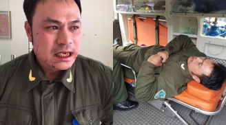 Nhân viên an ninh sân bay Nội Bài bị hành hung dã man