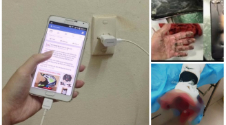 Lời cảnh tỉnh từ vụ việc tại Nam Định: Vừa sạc vừa dùng điện thoại, thiếu niên 17 tuổi bị nát lìa bàn tay