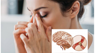 7 dấu hiệu báo động tắc nghẽn động mạch gây ĐỘT QUỴ rất nhiều người thường chủ quan bỏ qua