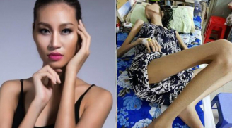Cảnh báo từ vụ: Người mẫu Kim Anh qua đời vì ung thư buồng trứng, phụ nữ có đặc điểm này dễ mắc bệnh