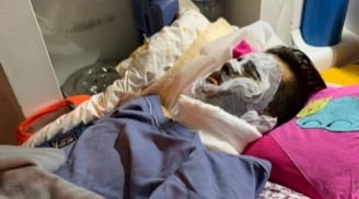 Việt kiều bị tạt axít và chém gân chân: Bố nạn nhân tiết lộ nguyên nhân anh trai vội vã rời Việt Nam