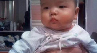 Mẹ khóc ngất khi nghe bác sĩ nói nguyên nhân khiến con gái 2 tuổi ngực lớn bất thường