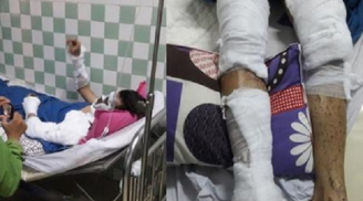 Tình tiết sốc vụ đôi nam nữ Việt Kiều bị tạt axit, cắt gân chân khi về quê ăn Tết