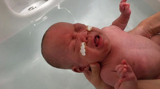 Hành trình kỳ diệu của cậu bé nhỏ nhất thế giới khi sinh ra chưa đầy 3 lạng