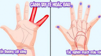 Dấu hiệu bàn tay cảnh báo căn bệnh vô cùng nguy hiểm rất nhiều người Việt vẫn cố tình bỏ qua