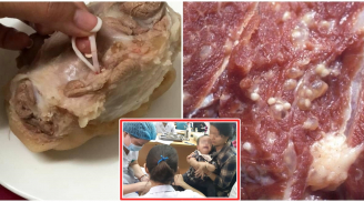 Báo động: Sán lợn hoành hành tấn công cơ thể người, thấy thịt có dấu hiệu này cố ăn là DÍNH