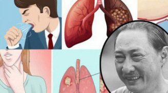 Nghệ sĩ Lê Bình qua đời vì ung thư phổi: Bác sĩ chỉ ra thủ phạm gây bệnh vô cùng quen mặt