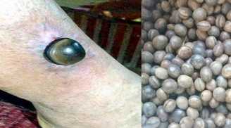 Sự thật về hạt đậu Lào được ví như THẦN DƯỢC “chữa bách bệnh”: Chuyên gia TIẾT LỘ điều này khiến bạn “ngã ngửa”