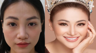 Hoa hậu Phương Khánh gây sốc với số lần phẫu thuật thẩm mỹ để có nhan sắc như hiện tại