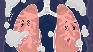 5 dấu hiệu cảnh báo phổi có vấn đề, nguy hiểm khó lường, hãy nhanh đi gặp bác sĩ ngay còn kịp