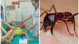Bé 3 tuổi nguy kịch vì kiến cắn: BS mách mẹ cách xử lý vết thương do côn trùng