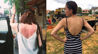 Sai lầm mặc đồ mỏng, ngắn mùa hè không những không mát mà còn khiến chị em hớ hênh