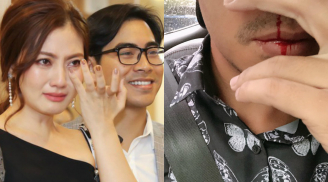 Thanh Bình - ông xã Ngọc Lan liên tục chảy máu cam khiến nhiều người lo lắng