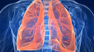 Điểm danh 5 thực phẩm giải độc và làm sạch phổi giúp phòng tránh ung thư hiệu quả số 1