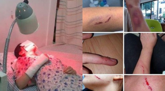 Cô gái ngoại quốc bị người phụ nữ đánh đập rồi cắn vào mặt trong nhà vệ sinh, nguyên nhân mới khiến bất ngờ