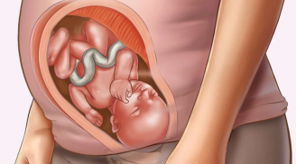 Dị tật thai nhi do mẹ thường ăn những thực phẩm này trong giai đoạn đầu của thai kỳ, mẹ nắm để tránh