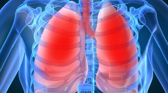8 dấu hiệu cảnh báo ung thư phổi mà rất nhiều người vẫn bỏ qua