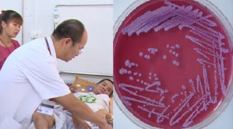 Nhiều người nhập viện vì nhiễm 'vi khuẩn ăn thịt người': Bệnh này có điều trị được không?
