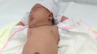 Bé gái chào đời với cân nặng 5,2kg đến y bác sĩ cũng phải bất ngờ