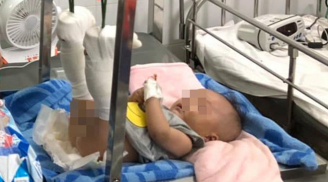 Cha ruột đánh con trai 4 tháng tuổi gãy chân, xuất huyết não chỉ vì bé khóc không chịu nín