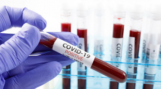 Chuyên gia Trung Quốc: Người nhóm máu A dễ nhiễm Covid-19