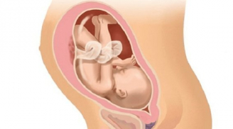 Ngày sinh sắp đến nhưng thai nhi chưa chịu quay đầu, 7 việc mẹ bầu cần phải làm