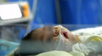 Bé 2 tháng tuổi bị xuất huyết não, bác sĩ chỉ ra thói quen kiêng cữ tai hại của mẹ