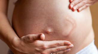 5 thay đổi khó tin trên cơ thể mẹ sau sinh, điều đầu tiên gây 'sốc'
