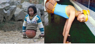 Điều phi thường về nữ kình ngư làm bóng rổ làm chân