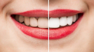 5 cách giúp đánh bay vết ố vàng trên răng ngay tại nhà, hiệu quả không kém gì tẩy trắng