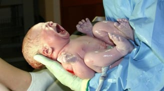 Tại sao em bé sơ sinh khi vừa chào đời phải khóc? Bạn đã biết lý do chưa?