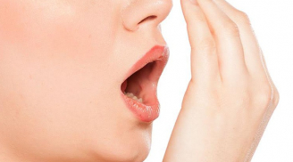 Chuyên gia mách bạn cách chữa hôi miệng tại nhà hiệu quả