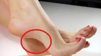 Môt người sở 4 tướng bàn chân này: Giàu sang từ trứng nước, muốn nghèo khổ cũng khó